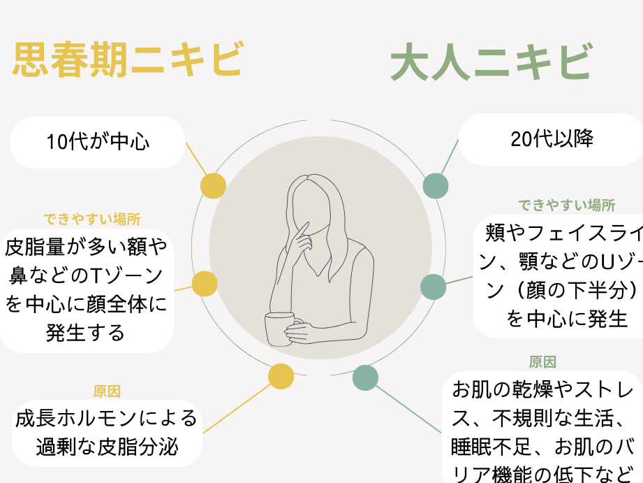 ニキビ あえて何もしない対策とその効果について