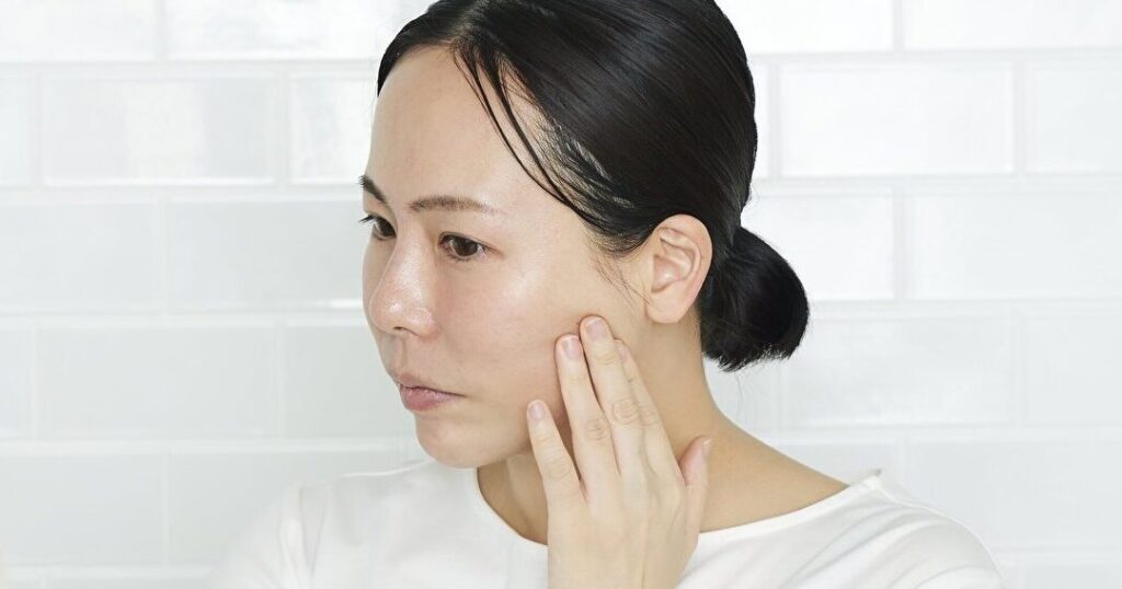 ニキビが左右対称になる理由とは何か