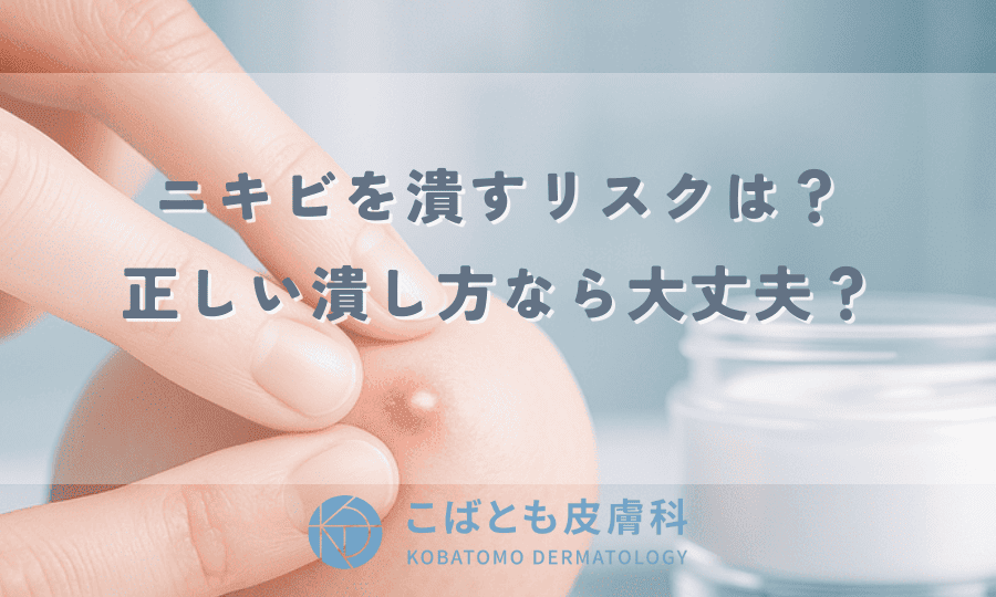 ニキビを潰すとどうなる？肌への影響とリスク