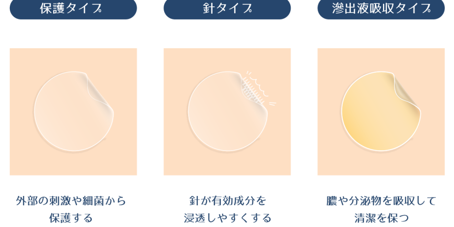 ニキビパッチ 朝夜どっちが効果的かを解説しま?