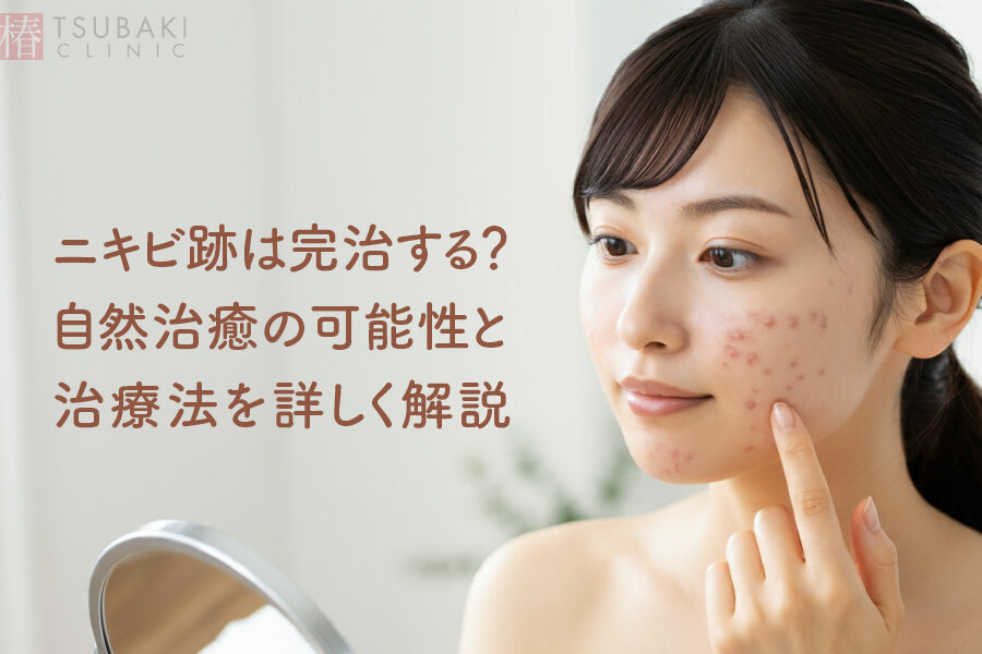 ニキビ跡 いつ消える？回復までの期間と対策を解説