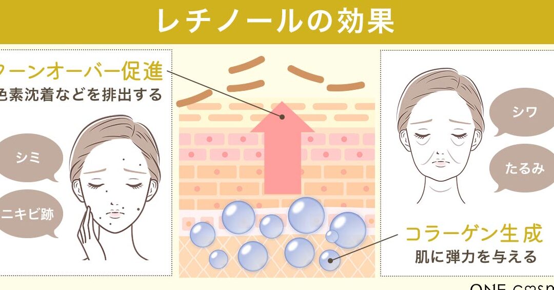 ニキビ跡に効果的なレチノールとビタミンCの比較