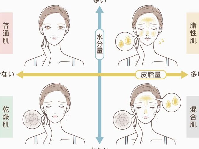 化粧するとニキビできる 知恵袋の原因と対策まとめ