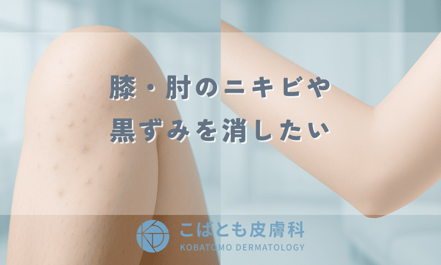 膝ニキビなぜ発生するのか原因と対策について